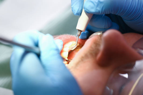 Best Emergency Dental Care for Broken or Chipped Teeth in Mclouth, KS