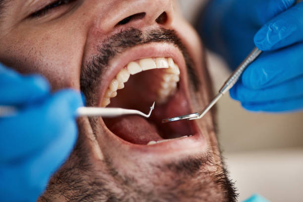 Best Emergency Root Canal Treatment in Mclouth, KS